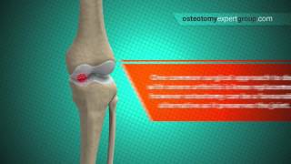 OMT Somatic Dysfunction Cervical Spine [upl. by Atiek562]