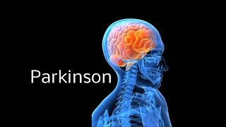 Parkinson leicht erklärt Einfach erklärt [upl. by Etnoel]