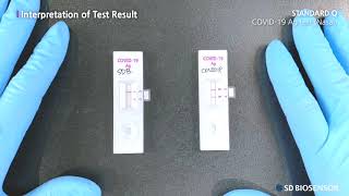 English subtitle Guide for STANDARD Q COVID19 Ag Test Nasal professional use only [upl. by Avlis]