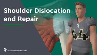 Traumatic Knee Dislocation ReductionQuick Version [upl. by Suryc906]