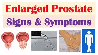 TURP Surgery  BPH Treatment  Prostate Treatment  Enlarged Prostate Surgery  Pristyn Care [upl. by Koo]