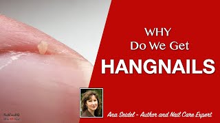 Why Do We Get Hangnails [upl. by Noakes]