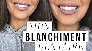 COMMENT JAI BLANCHI MES DENTS  MON BLANCHIMENT DENTAIRE [upl. by Stilwell]