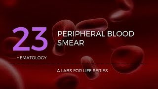 Part 1  Preparation of Peripheral Blood Smear PBS [upl. by Ihpen]