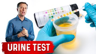 Urine Test Simplified [upl. by Ettelrats]