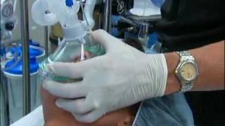 NT About Anesthesia Ch 5  General Anesthesia [upl. by Dillie]