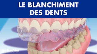 Blanchiment dentaire © [upl. by Adnolor969]