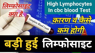 High Lymphocytes In Blood Test Causes Treatment  high lymphocytes in hindi लिम्फोसाइट्स क्या है [upl. by Abisia]