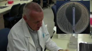 Etest for antibiotic susceptibility [upl. by Dine399]