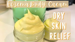 How to Make Homemade Eczema Cream  DIY Natural Itch Relief for Dry Skin [upl. by Valdis]