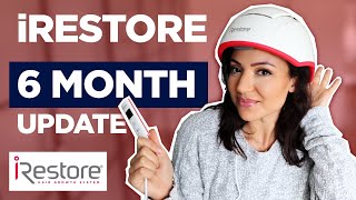 iRestore 6 Month Hair Loss Update Red Light Laser Hair Growth Therapy [upl. by Epilef]