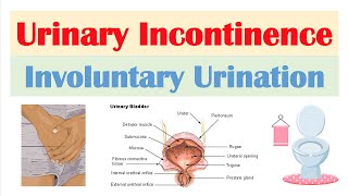 Urinary Incontinence Stress Urge Overflow amp Functional  Causes Symptoms Diagnosis Treatment [upl. by Leehar]