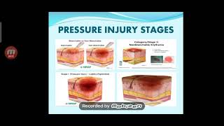 Pressure Injury Wounds vs Pressure Ulcer Discussion [upl. by Osbourne]