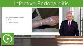 Infective Endocarditis IE Definition amp Epidemiology– Infectious Diseases  Lecturio [upl. by Tshombe]