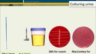 Urine Culture How To Interpret Count [upl. by Hamilah138]