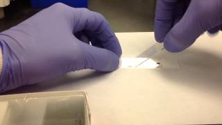 Hematology Making a Peripheral Blood Smear [upl. by Dennet463]