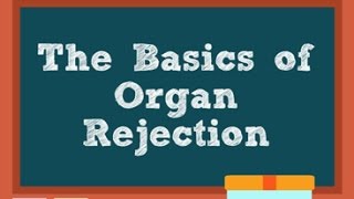 Basics of organ rejection [upl. by Aitra113]