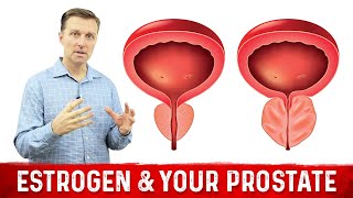 Enlarged Prostate Causes Symptoms and Treatment [upl. by Link]