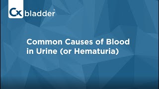 What Causes Blood in Urine  Cxbladder [upl. by Suh78]